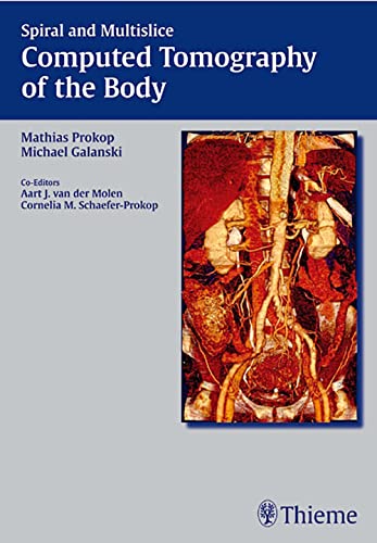 

clinical-sciences/radiology/spiral-and-multislice-computed-tomography-of-the-body-1-ed-9783131164810