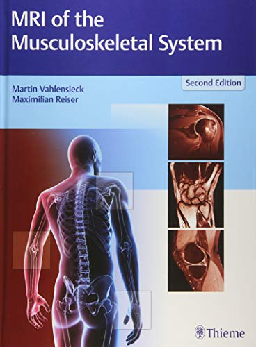 

exclusive-publishers/thieme-medical-publishers/mri-of-the-musculoskeletal-system-2-e--9783131165725