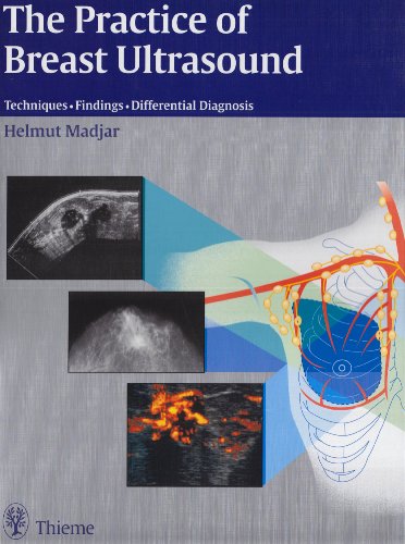 

general-books/general/the-practice-of-breast-ultrasound--9783131243416