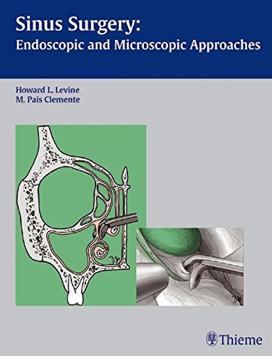 

exclusive-publishers/thieme-medical-publishers/sinus-surgery-endoscopic-and-microscopic-approaches-1-ed--9783131247919