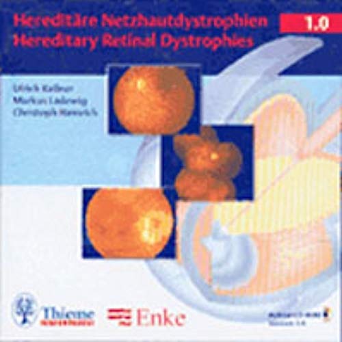 

exclusive-publishers/thieme-medical-publishers/hereditary-retinal-dystrophy-cd-rom-9783131263711