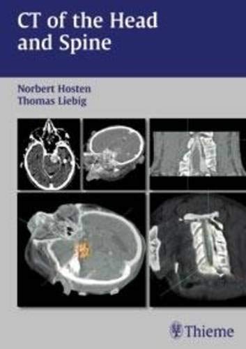 

exclusive-publishers/thieme-medical-publishers/ct-of-the-head-and-spine-1-e--9783131267115