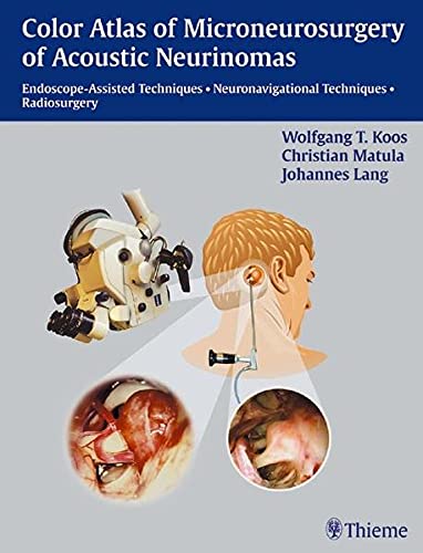 

surgical-sciences/nephrology/color-atlas-of-microsurgery-of-acoustic-neurinomas-endoscope-assisted-techniques---neuronavigational-techniques---radiosurgery-1-e-9783131276612