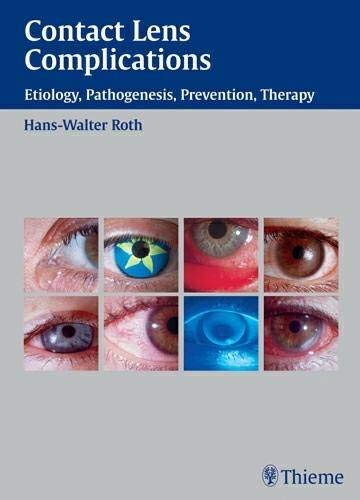 

exclusive-publishers/thieme-medical-publishers/contact-lens-complications-etiology-pathogenesis-prevention-therapy-1-e-9783131277916