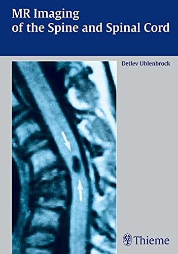

clinical-sciences/radiology/mr-imaging-of-the-spine-and-spinal-cord-1-e-9783131309419