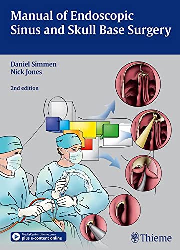 

exclusive-publishers/thieme-medical-publishers/manual-of-endoscopic-sinus-surgery--9783131309723