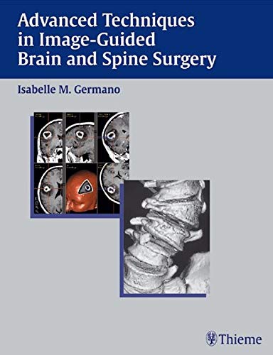 

exclusive-publishers/thieme-medical-publishers/advanced-techniques-in-image-guided-brain-and-spine-surgery-1-ed--9783131315212