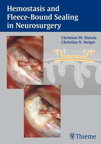 

surgical-sciences/nephrology/hemostasis-and-fleece-bound-sealing-in-neurosurger-1-ed-9783131320414