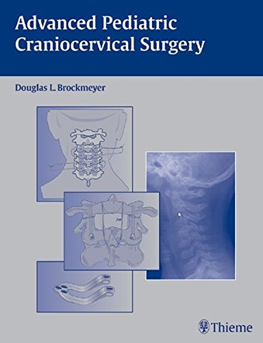 

exclusive-publishers/thieme-medical-publishers/advanced-pediatric-craniocervical-surgery--9783131320810