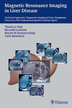 

mbbs/4-year/magnetic-resonance-imaging-in-liver-disease-technical-approach-diagnostic-imaging-of-liver-neoplasms-focus-on-a-new-superparamagnetic-contrast-agent-9783131331915
