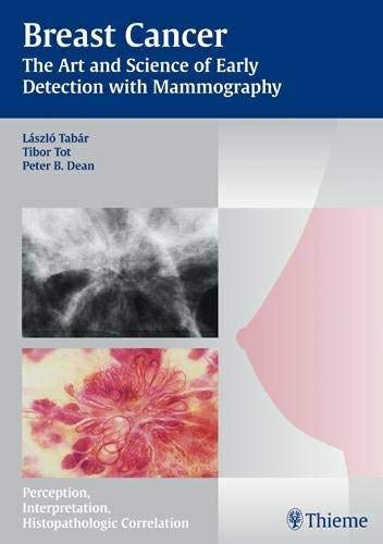 

mbbs/4-year/breast-cancer---the-art-and-science-of-early-detection-with-mammography-perception-interpretation-histopathologic-correlation-1-e--9783131353719
