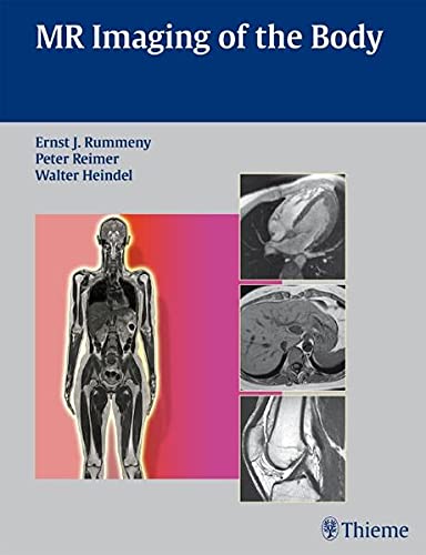 

exclusive-publishers/thieme-medical-publishers/mr-imaging-of-the-body--9783131358417