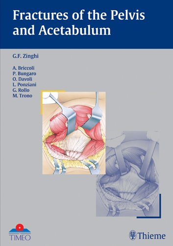 

general-books/general/fractures-of-the-pelvis-and-acetabulum-1-ed--9783131363817
