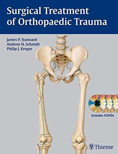 

general-books/general/surgical-treatment-of-orthopaedic-trauma-includes-4-dvds-1-ed--9783131369413