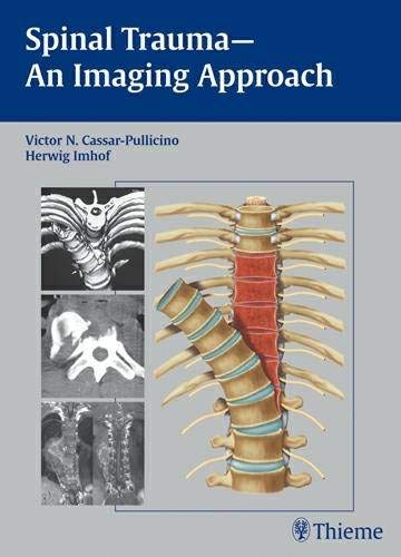 

mbbs/4-year/spinal-trauma---an-imaging-approach-1-e-9783131374714