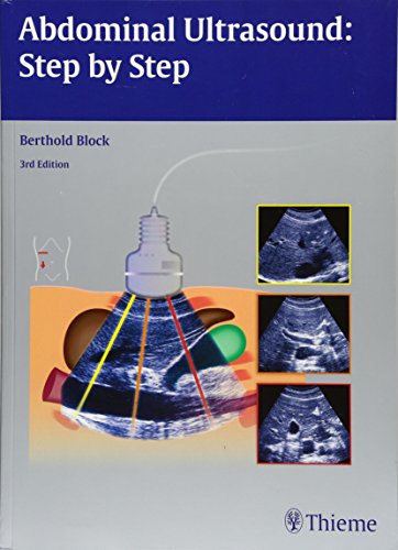 

exclusive-publishers/thieme-medical-publishers/abdominal-ultrasound-step-by-step-3-e--9783131383631