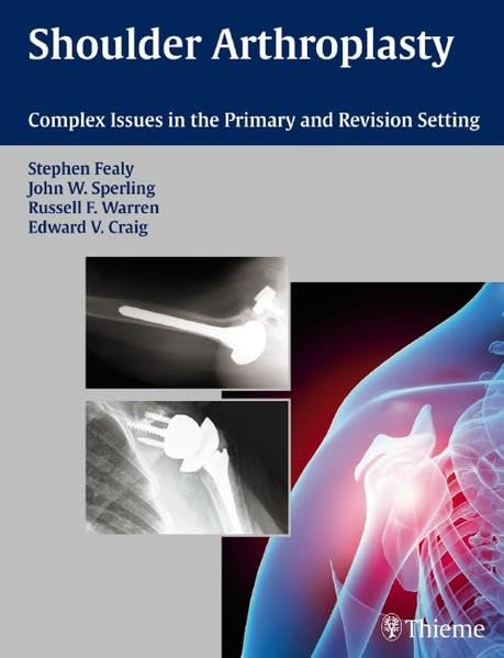 

surgical-sciences/orthopedics/shoulder-arthroplasty-complex-issues-in-the-primary-and-pevision-setting1ed-9783131390615