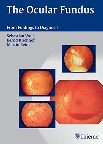 

mbbs/3-year/the-ocular-fundus-from-findings-to-diagnosis-1-e--9783131393715