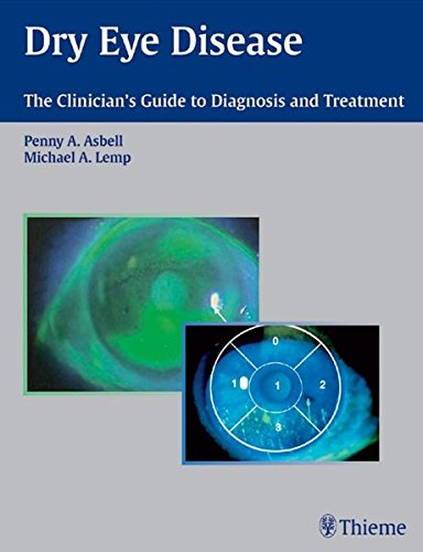 

surgical-sciences/ophthalmology/dry-eye-disease-the-clinician-s-guide-to-diagnosis-and-treatment-9783131397713