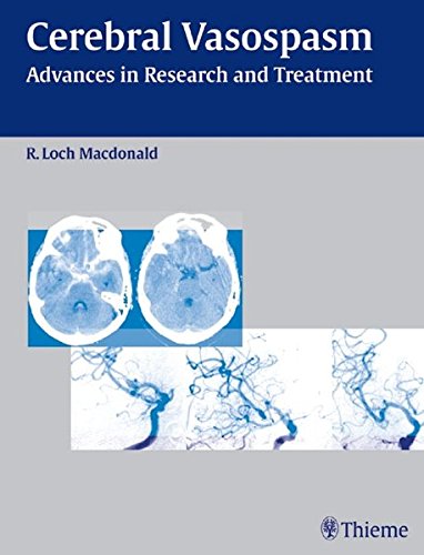 

exclusive-publishers/thieme-medical-publishers/cerebral-vasopasm-advances-in-research-and-treatment-1-ed--9783131400611