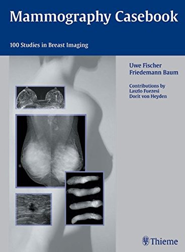 

surgical-sciences/oncology/mammography-casebook-1-e--9783131403513