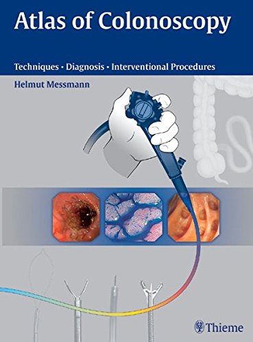 

clinical-sciences/medical/atlas-of-colonoscopy-techniques-diagnosis-interventional-procedures--9783131405715