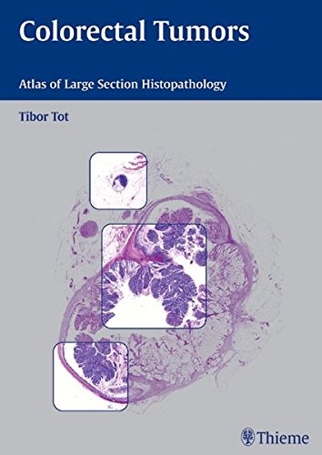 

basic-sciences/pathology/colorectal-tumors-atlas-of-large-section-histopathology-1-e--9783131405913