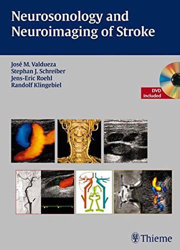 

exclusive-publishers/thieme-medical-publishers/neurosonology-and-neuroimaging-of-stroke-1-e--9783131418715