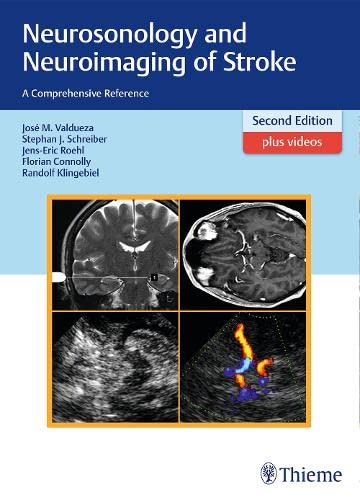 

exclusive-publishers/thieme-medical-publishers/neurosonology-and-neuroimaging-of-stroke-a-comprehensive-reference-2-e--9783131418722