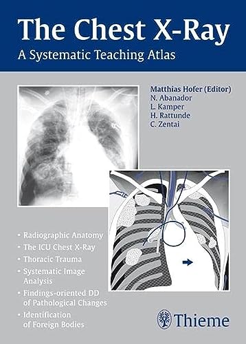 

exclusive-publishers/thieme-medical-publishers/the-chest-x-ray-a-systematic-teaching-atlas-1-e-9783131442116