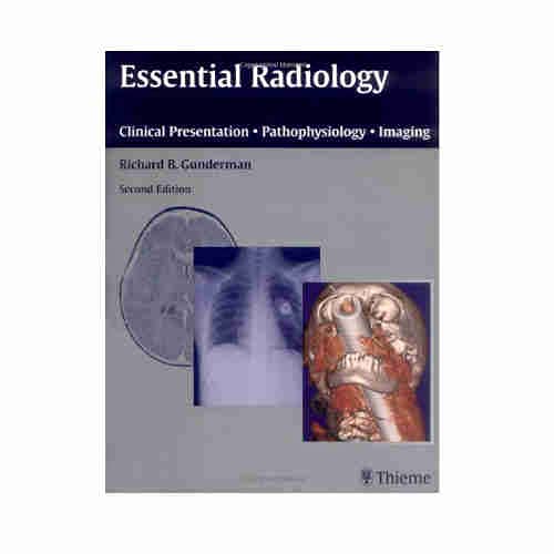 

exclusive-publishers/thieme-medical-publishers/essntial-radiology-2ed-clinical-presentation-pathophysiology-imaging--9783131446213