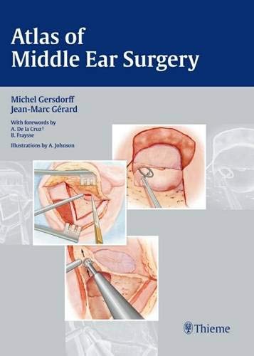 

exclusive-publishers/thieme-medical-publishers/atlas-of-middle-ear-surgery-9783131450418