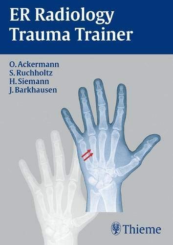 

general-books/general/er-radiology-trauma-trainer-1-e--9783131454416