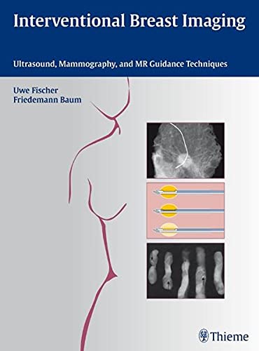 

exclusive-publishers/thieme-medical-publishers/interventional-breast-imaging-9783131467010