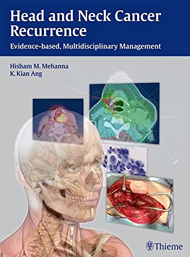 HEAD AND NECK CANCER RECURRENCE EVIDENCE-BASED MUL