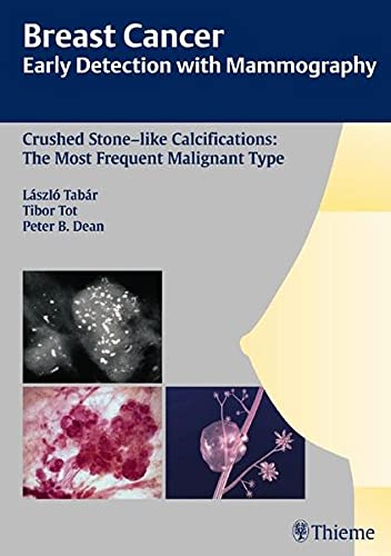 

exclusive-publishers/thieme-medical-publishers/breast-cancer-early-detection-with-mammography-crushed-stone-like-calcifications-the-most-frequen-9783131485311
