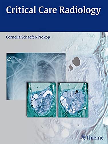 

exclusive-publishers/thieme-medical-publishers/critical-care-radiology-9783131500519