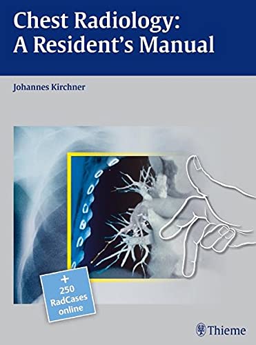 RADCASES CHEST RADIOLOGY A RESIDENTS MANUAL