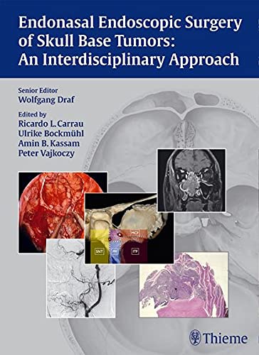 

exclusive-publishers/thieme-medical-publishers/endonasal-endoscopic-surgery-of-skull-base-tumors-an-interdisciplinary-approach-1-e--9783131546715