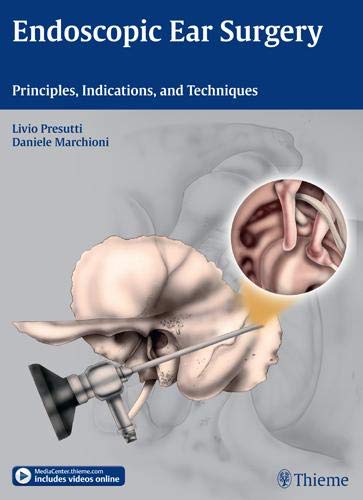 

exclusive-publishers/thieme-medical-publishers/endoscopic-ear-surgery-principles-indications-and-techniques-1-e--9783131630414