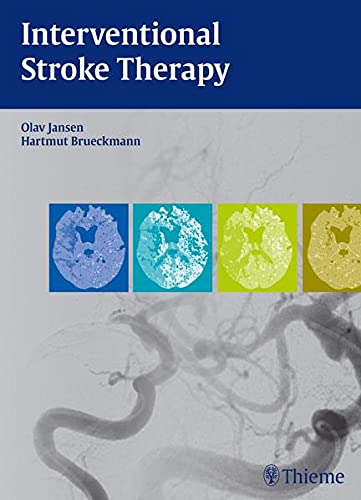 

surgical-sciences/nephrology/interventional-stroke-therapy-1-e--9783131699213