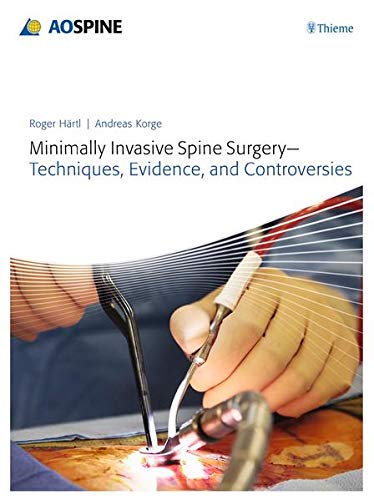 

mbbs/4-year/minimally-invasive-spine-surgery-techniques-evidence-and-controversies-9783131723819