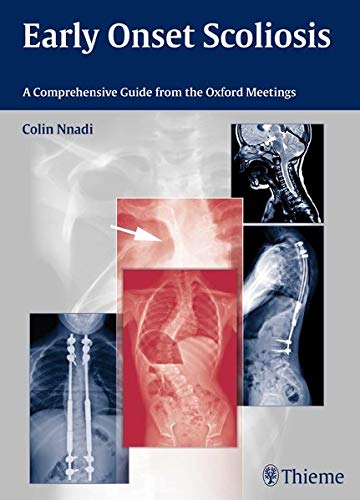 

surgical-sciences/nephrology/early-onset-scoliosis-a-comprehensive-guide-from-the-oxford-meetings-1-e-9783131726612