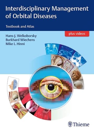 

exclusive-publishers/thieme-medical-publishers/interdisciplinary-management-of-orbital-diseases-textbook-and-atlas-1-e--9783131994219