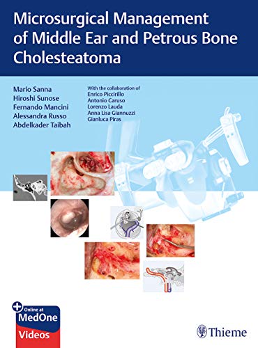 

exclusive-publishers/thieme-medical-publishers/microsurgical-management-of-middle-ear-and-petrous-bone-cholesteatoma-1-e--9783132000056
