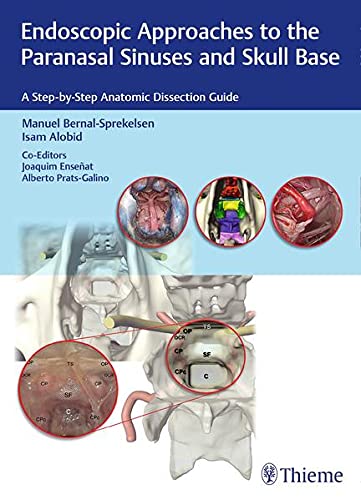 

exclusive-publishers/thieme-medical-publishers/endoscopic-approaches-to-the-paranasal-sinuses-and-skull-base-a-step-by-step-anatomic-dissection-guide-1-e--9783132018815