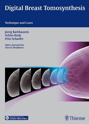 

exclusive-publishers/thieme-medical-publishers/digital-breast-tomosynthesis-technique-and-cases-1-e--9783132031616