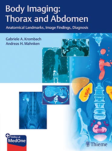 

exclusive-publishers/thieme-medical-publishers/body-imaging-thorax-and-abdomen-anatomical-landmarks-image-findings-diagnosis-1-e--9783132054110