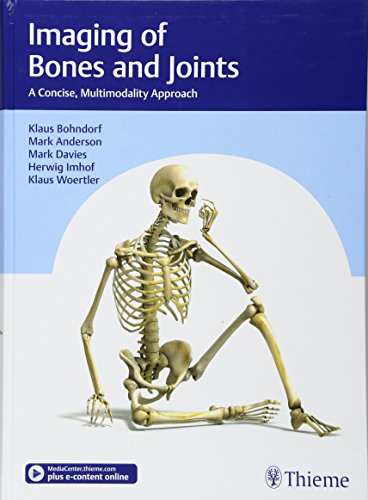 

exclusive-publishers/thieme-medical-publishers/imaging-of-bones-and-joints-a-concise-multimodality-approach-1-e--9783132406476