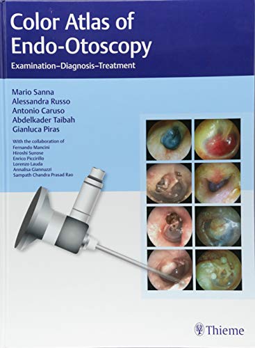 

exclusive-publishers/thieme-medical-publishers/color-atlas-of-endo-otoscopy-examination-diagnosis-treatment-1-e--9783132415232
